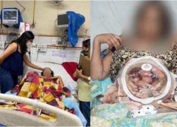 নৱবিবাহিতাক স্বামীগৃহই খুৱালে এচিড; শৰীৰ আৰু পেটৰ অংগ সম্পূৰ্ণভাৱে যাই জ্বলি