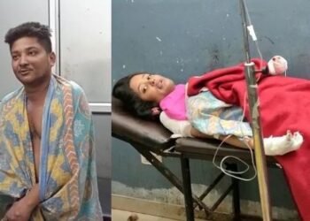জন্মদিনৰ কেক কাটি থাকোতে লাগিল কাজিয়া; যুৱকে নিজৰ গাতে পেট্ৰ’ল ঢালি লগাই দিয়ে জুই, যুৱতীয়ে চেষ্টা কৰিলে জুই নুমুৱাবলৈ, পৰিণতিত দুয়োগৰাকী অগ্নিদগ্ধ