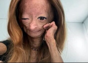 এক অদ্ভুত ৰোগত ভুগি আছিল YouTube star; ১৫ বছৰ বয়সতে ‘বুঢ়ী’ হৈ ত্যাগ কৰিলে পৃথিৱী