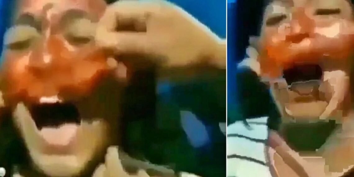 দেখিবলৈ ধুনীয়া হ’বলৈ গৈ যুৱতীয়ে নিজৰে কৰিলে এই অৱস্থা; কান্দি কান্দি আঁতৰালে Face Mask, চাওক Viral Video