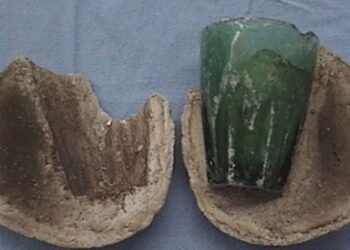 OMG! মহিলাৰ ‘গুপ্তাংগ’ৰ পৰা ওলাল এটা আইনাৰ গিলাচ (Glass) ; ৪ বছৰ ধৰি সোমাই আছিল গিলাচটো, কিছু বছৰ পূৰ্বে মহিলাগৰাকীৰ ওপৰত চলিছিল যৌন নিৰ্যাতন, চিকিৎসকো আচৰিত