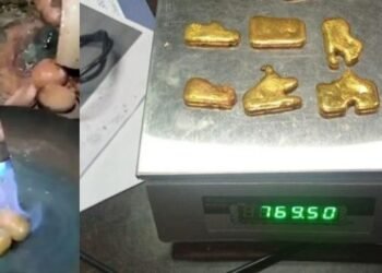 Technologyৰ আগত ফেইল! ‘গুহ্যদ্বাৰ’ত (Rectum) ৪১ লাখ টকাৰ সোণ (Gold) লুকুৱাই আনিছিল এজন লোকে; এনেদৰে পৰিল ধৰা…