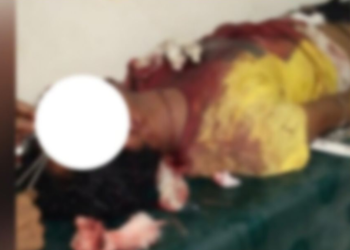 ভুল কাৰ? প্ৰেম-প্ৰতাৰণা-হত্যাৰ চেষ্টা; বিবাহিত পুৰুষে প্ৰেমৰ সম্পৰ্ক গঢ়িছিল এগৰাকী যুৱতীৰে, কিন্তু প্ৰেমিকাই জনা নাছিল যে প্ৰেমিক বিবাহিত বুলি, গম পোৱাৰ পিছত প্ৰেমিকাই ডিঙি কাটিলে বিবাহিত প্ৰেমিকৰ