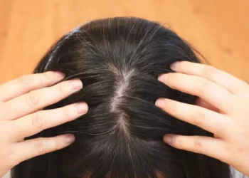 Lifestyle Tips: পকা চুলিৰ (White Hair) সমস্যা হৈছে নেকি আপোনাৰ? যদি হৈছে তেন্তে পুৱাই উঠি ব্যৱহাৰ কৰক এইবিধ বস্তু, অতি সোনকালে পাব লাভালাভ, পিছে জানো আহক কি?