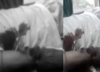 খুবেই ভয়ংকৰ (Horrific)! ব্লক নিৰ্মাণ কৰা কাৰখানাৰ মেচিনত সোমাই কাটি গ’ল এজন শ্ৰমিকৰ হাত; এতিয়া হাস্পতালত ছটফটাইছে বিষত, হাহাকাৰ অঞ্চলজুৰি