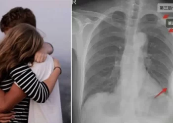 আজৱ ঘটনা! এজন যুৱকে এগৰাকী যুৱতীক ইমান জোৰেৰে সাৱটি (Hug) ধৰিলে যে; ভাঙি গ’ল যুৱতীৰ বুকুৰ ৩ ডাল হাঁড়, তাৰ পিছত…