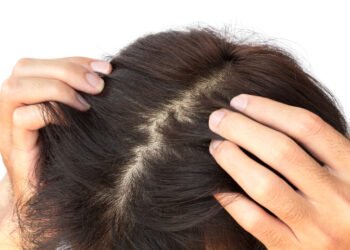 Lifestyle Tips: চুলি সৰা (Hair Fall) আৰু পাতল চুলিৰ (Thinning Hair) সমস্যাত ভুগি আছে নেকি? যদি ভুগিছে তেন্তে এই টিপছ আপোনাৰ বাবেই; কেৱল এই ২ বিধ বস্তু নাৰিকল তেলত মিহলি কৰক, পিছে জানো আহক কি কি?