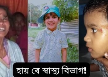 হায় ৰে স্বাস্থ্য বিভাগ! ৩ মাহ পূৰ্বে এটি ৪ বছৰীয়া শিশুক কামুৰিছিল কুকুৰে; কিন্তু চিকিৎসকে ৰেবিছ ইঞ্জেকচন দিয়াৰ পৰিৱৰ্তে এটা TTবেজী আৰু মলম লগাই পঠাই দিছিল, এতিয়া কৰুণ মৃত্যুক সাৱটিলে শিশুটিয়ে