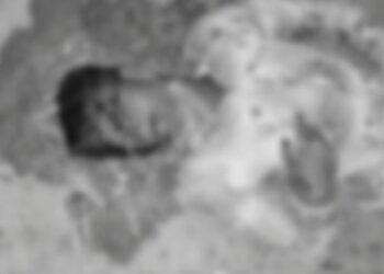 কেৱল প্ৰেমৰ বাবে! হোষ্টেলৰ পৰা প্ৰেমিকাক পলুৱাই লৈ গৈছিল প্ৰেমিকে;  পিছে-পিছে খেদিলে প্ৰেমিকাৰ পৰিয়ালে, ধৰা পৰিব বুলি প্ৰেমিকে স্পীডত চলালে বাইক, তাৰ পিছত ভয়ংকৰ বাইক দুৰ্ঘটনা, গুৰুতৰভাবে আহত প্ৰেমিক
