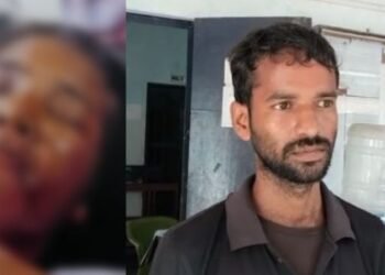 ভয়ংকৰ! পাৰিবাৰিক কন্দলৰ ভয়ংকৰ পৰিণতি; স্বামীয়ে এচিডেৰে আক্ৰমণ (Acid Attack) কৰিলে পত্নীক, ৯০ শতাংশই জ্বলি গৈছে মুখ, এতিয়া জীৱন-মৃত্যুৰে যুঁজ দিছে পত্নীয়ে