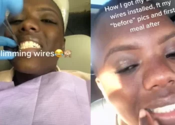 আজৱ ঘটনা! ওজন কমোৱাৰ ধৰিলে জেদ; তাঁৰেৰে চিলাই দিলে নিজৰ আটাইকেইটা দাঁত, সম্পূৰ্ণ ঘটনাটো এনেধৰণৰ…